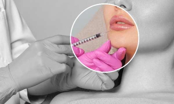 Lip Filler Tyldesley 