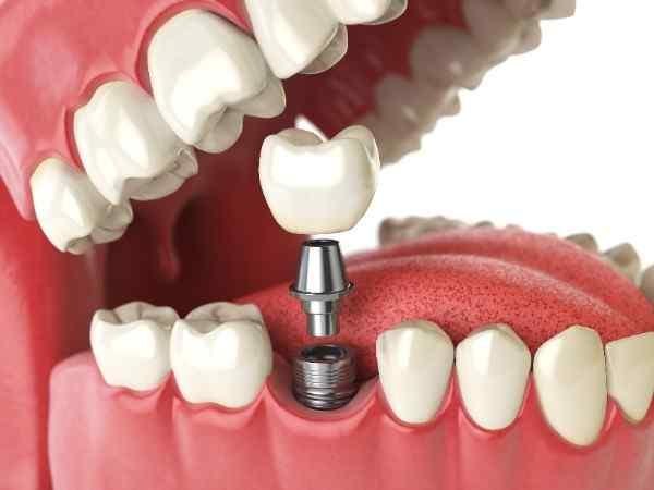  Emergency dentist in Newcastle