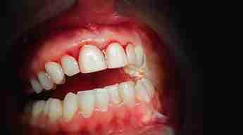 Image Source -Directory dental Manchester 