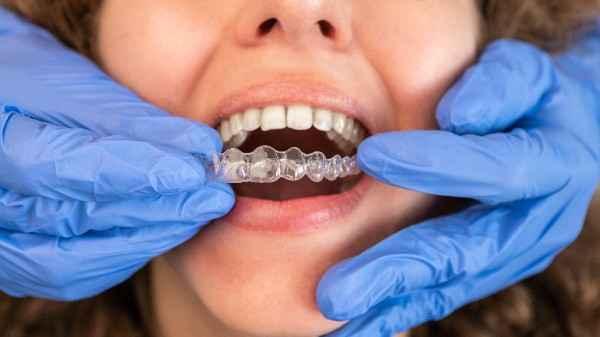 invisalign Sheffield